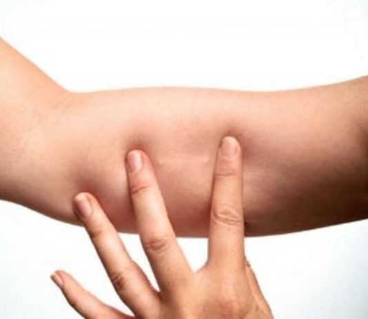 Complicatii ale implantului contraceptiv