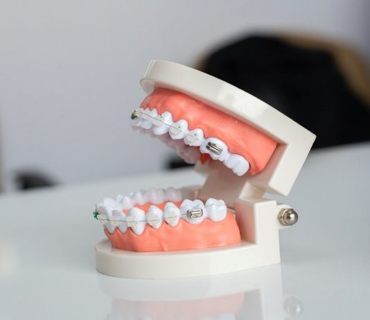 Abcesul gingival, una dintre cele mai frecvente urgențe stomatologice
